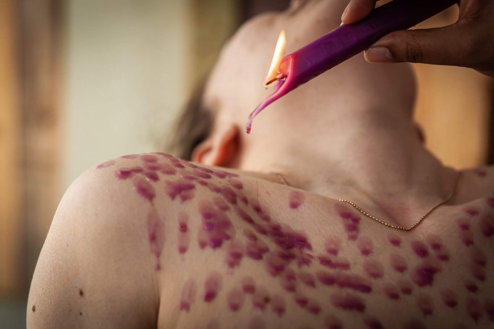mg 3594 Purple wax dripped onto person's skin from candle.